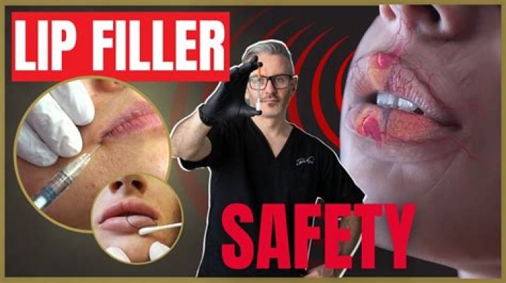 Unveiling The Dangers Of "Too Much Lip Filler": Risks, Consequences, And Prevention