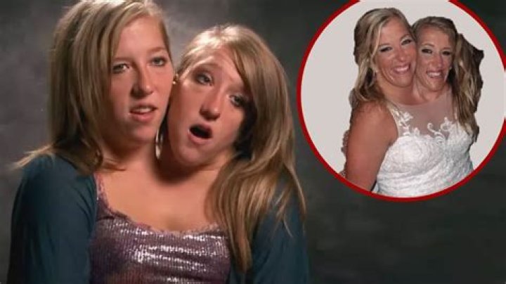 Unveiling The Extraordinary Lives Of Abby And Brittany: Discoveries And Insights