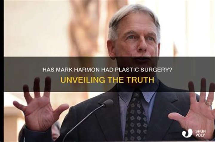 Unveiling The Truth: "Mark Harmon Died"